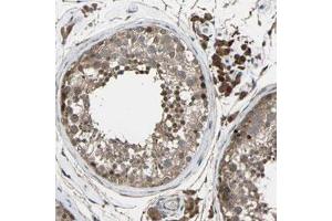 Immunohistochemical staining (Formalin-fixed paraffin-embedded sections) of human testis with CHST9 polyclonal antibody  shows strong cytoplasmic positivity in Leydig cells, cells in seminiferous ducts were moderately stained at 1:200-1:500 dilution.