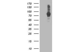 Western Blotting (WB) image for anti-phosphodiesterase 4B, cAMP-Specific (PDE4B) antibody (ABIN1500091) (PDE4B 抗体)