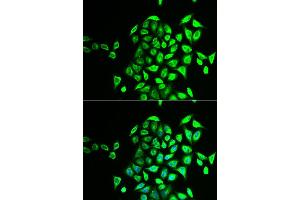 Immunofluorescence analysis of U2OS cell using NAPG antibody. (NAPG 抗体)