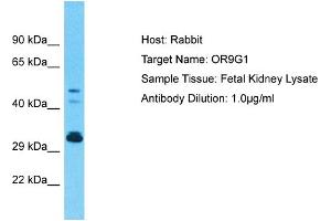 Host: Rabbit Target Name: OR9G1 Sample Type: Fetal Kidney lysates Antibody Dilution: 1. (OR9G1 抗体  (C-Term))