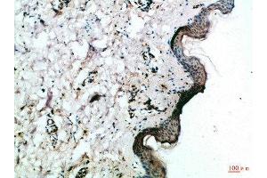 Immunohistochemical analysis of paraffin-embedded Human-skin, antibody was diluted at 1:100 (FZD4 抗体  (AA 11-60))