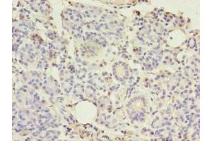 Immunohistochemistry of paraffin-embedded human pancreatic tissue using ABIN7148290 at dilution of 1:100 (TMEM27 抗体  (AA 15-141))