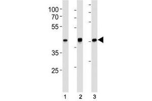 TBP antibody western blot analysis in (1) HeLa, (2) HepG2, (3) mouse NIH3T3 lysate. (TBP 抗体)