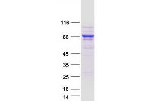 Validation with Western Blot