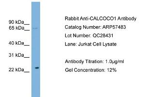 WB Suggested Anti-CALCOCO1  Antibody Titration: 0. (CALCOCO1 抗体  (N-Term))