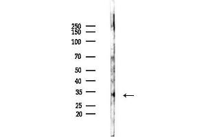 Western blot analysis of lysates from EC304 cells(heat-shock,45 min treatment), using PITX1 Antibody at 1/1000 dilution.