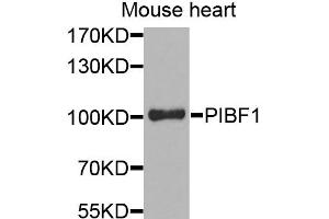 Western blot analysis of extracts of mouse heart, using PIBF1 antibody. (PIBF1 抗体)