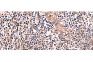 Immunohistochemistry of paraffin-embedded Human tonsil tissue using MGP Polyclonal Antibody at dilution of 1:75(x200) (MGP 抗体)