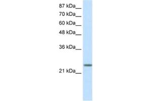 Western Blotting (WB) image for anti-MAX Dimerization Protein 3 (MXD3) antibody (ABIN2460166) (MXD3 抗体)