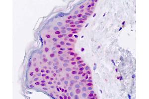 Human, Skin; Formalin-Fixed Paraffin-Embedded (FFPE) (DIS3 抗体  (AA 295-323))