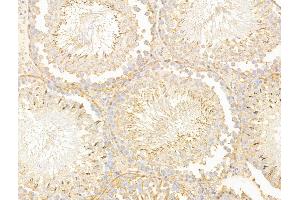 ABIN7094808 and ABIN7098859 at 1/100 staining Rat testis tissue by IHC-P.