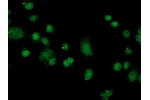 Anti-FKBPL mouse monoclonal antibody (ABIN2454034) immunofluorescent staining of COS7 cells transiently transfected by pCMV6-ENTRY FKBPL (RC202153). (FKBPL 抗体)