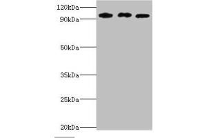 Western blot All lanes: SOX6 antibody at 10 μg/mL Lane 1: Jurkat whole cell lysate Lane 2: Hela whole cell lysate Lane 3: 293T whole cell lysate Secondary Goat polyclonal to rabbit IgG at 1/10000 dilution Predicted band size: 92, 90, 89 kDa Observed band size: 92 kDa (SOX6 抗体  (AA 1-74))