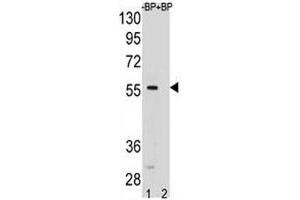 SMAD5 antibody pre-incubated without (lane 1) and with (2) blocking peptide in HeLa lysate. (SMAD5 抗体  (AA 241-269))