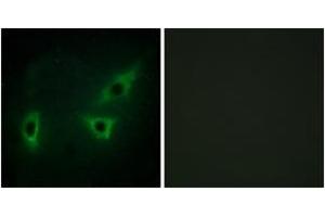 Immunofluorescence analysis of HeLa cells, using ATP7B Antibody. (ATP7B 抗体  (AA 161-210))