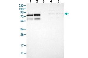 Western blot analysis of Lane 1: RT-4, Lane 2: U-251 MG, Lane 3: Human Plasma, Lane 4: Liver, Lane 5: Tonsil with MTA2 polyclonal antibody  at 1:250-1:500 dilution. (MTA2 抗体)