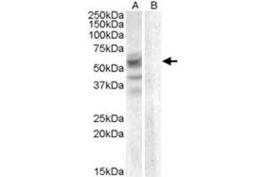 ARSD polyclonal antibody  (0. (Arylsulfatase D 抗体)