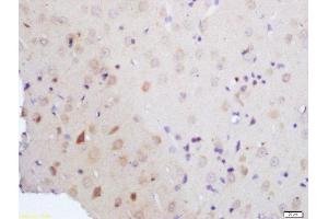 Formalin-fixed and paraffin embedded rat brain tissue labeled with Rabbit Anti-Vitamin D3 Receptor Polyclonal Antibody, Unconjugated (ABIN2559664) at 1:200 followed by conjugation to the secondary antibody and DAB staining (Vitamin D Receptor 抗体  (AA 51-150))