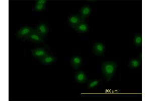 Immunofluorescence of monoclonal antibody to MKRN2 on HeLa cell.