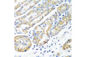 Immunohistochemistry of paraffin-embedded human stomach using MSRB2 antibody at dilution of 1:100 (40x lens). (MSRB2 抗体)