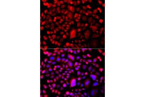 Immunofluorescence analysis of A549 cell using TP53BP2 antibody. (TP53BP2 抗体)