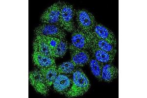 Immunofluorescence (IF) image for anti-C-Abl Oncogene 1, Non-Receptor tyrosine Kinase (ABL1) antibody (ABIN3003438) (ABL1 抗体)