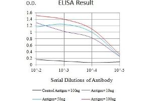 Black line: Control Antigen (100 ng),Purple line: Antigen (10 ng), Blue line: Antigen (50 ng), Red line:Antigen (100 ng) (IL5RA 抗体  (AA 21-196))