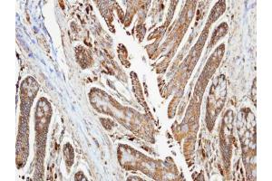 Immunohistochemistry (IHC) image for anti-NADH Dehydrogenase (Ubiquinone) 1 alpha Subcomplex, 10, 42kDa (NDUFA10) (Center) antibody (ABIN2855551)