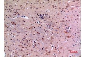 Immunohistochemistry (IHC) analysis of paraffin-embedded Rat Brain, antibody was diluted at 1:100. (GDI2 抗体  (C-Term))