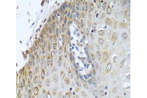 Immunohistochemistry of paraffin-embedded Human esophagus using POR Polyclonal Antibody at dilution of 1:100 (40x lens). (POR 抗体)