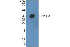 Detection of Recombinant HPR, Human using Polyclonal Antibody to Haptoglobin Related Protein (HPR)