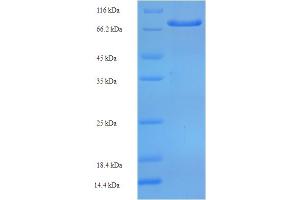 SDS-PAGE (SDS) image for Prolyl 4-Hydroxylase, Transmembrane (Endoplasmic Reticulum) (P4HTM) (AA 82-563) protein (His-SUMO Tag) (ABIN5711869) (P4HTM Protein (AA 82-563) (His-SUMO Tag))