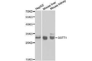 Western blot analysis of extracts of various cell lines, using GSTT1 antibody. (GSTT1 抗体)