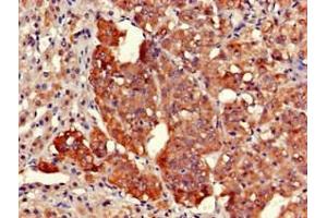 Immunohistochemistry of paraffin-embedded human adrenal gland tissue using ABIN7164525 at dilution of 1:100