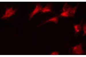 Immunofluorescence (fixed cells) (IF/ICC) image for anti-Protein Phosphatase, Mg2+/Mn2+ Dependent, 1K (PPM1K) (Internal Region) antibody (ABIN6259569)