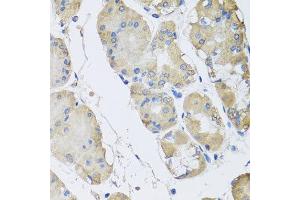 Immunohistochemistry of paraffin-embedded human gastric using RPLP1 antibody at dilution of 1:100 (x40 lens). (RPLP1 抗体)