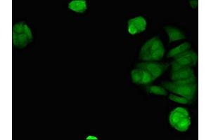 Immunofluorescent analysis of MCF-7 cells using ABIN7170794 at dilution of 1:100 and Alexa Fluor 488-congugated AffiniPure Goat Anti-Rabbit IgG(H+L) (STING/TMEM173 抗体  (AA 207-379))