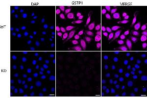 Immunocytochemical staining of HeLa cells using GSTP1 antibody (ABIN7798758), 1:1,000), Top panel: wild-type (WT), Bottom panal: GSTP1 shRNA knockdown (KD). (Recombinant GSTP1 抗体)