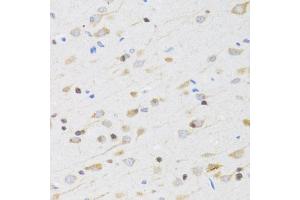 Immunohistochemistry of paraffin-embedded rat brain using CHRM5 antibody (ABIN1876555) at dilution of 1:100 (40x lens). (CHRM5 抗体)