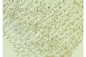 Immunohistochemistry (IHC) image for anti-Protein Phosphatase 2A Activator, Regulatory Subunit 4 (PPP2R4) (C-Term) antibody (ABIN6264394)