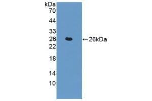 Detection of Recombinant TAGLN, Human using Polyclonal Antibody to Transgelin (TAGLN) (Transgelin 抗体  (AA 1-201))