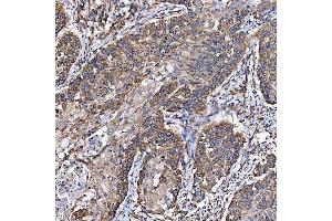 IHC analysis of SH2D4A using anti-SH2D4A antibody (ABIN7601695). (SH2D4A 抗体  (AA 42-454))