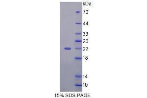 SDS-PAGE analysis of Human CDKN2D Protein. (CDKN2D 蛋白)