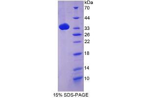 SDS-PAGE of Protein Standard from the Kit (Highly purified E. (Complement C4 ELISA 试剂盒)