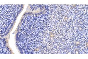 Immunohistochemistry (IHC) image for anti-Mitogen-Activated Protein Kinase 8 (MAPK8) (AA 138-382) antibody (ABIN7439324)
