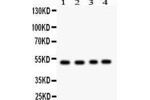 Western Blotting (WB) image for anti-Suppressor of Cytokine Signaling 4 (SOCS4) (AA 291-440) antibody (ABIN3043346) (SOCS4 抗体  (AA 291-440))