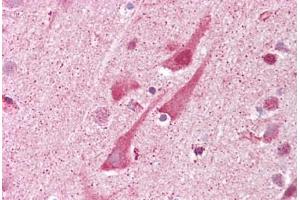 Anti-SHISA9 antibody IHC staining of human brain, cortex.
