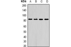Western blot analysis of AFAP1 expression in A549 (A), HepG2 (B), mouse liver (C), rat liver (D) whole cell lysates. (AFAP 抗体)