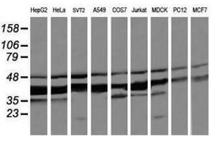 Image no. 1 for anti-Mitogen-Activated Protein Kinase Kinase 3 (MAP2K3) antibody (ABIN1499399) (MAP2K3 抗体)