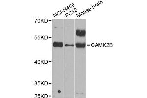 Western blot analysis of extracts of various cell lines, using CAMK2B antibody (ABIN5971341) at 1/1000 dilution. (CAMK2B 抗体)